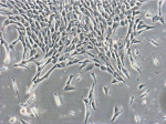 Mesenchymal stem cells
