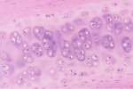 cartilage cells