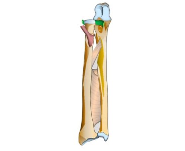 pediatric fractures radius and ulna