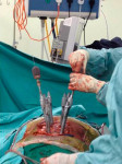 Minimally Invasive Spine Surgery