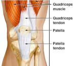 knee pain 