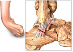 Ankle Ligament