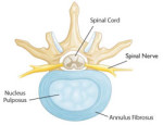 Spine Problems